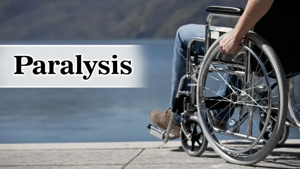 HOW TO CURE PARALYSIS NATURALLY